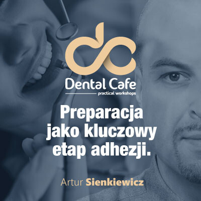 Preparacja jako kluczowy czynnik adhezji
