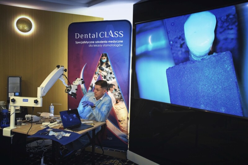 EN(DO)GINEERING Planowanie i przeprowadzanie procedur endodontycznych a biomechanika zęba