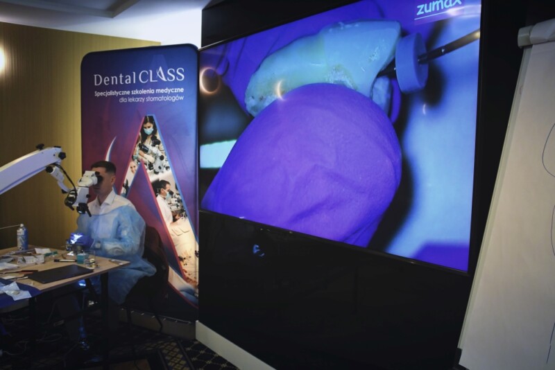 EN(DO)GINEERING Planowanie i przeprowadzanie procedur endodontycznych a biomechanika zęba