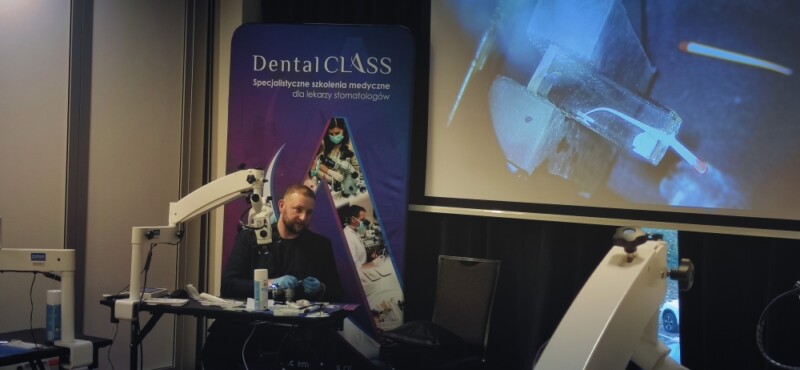 Obturacja systemu endodontycznego metodą termiczną