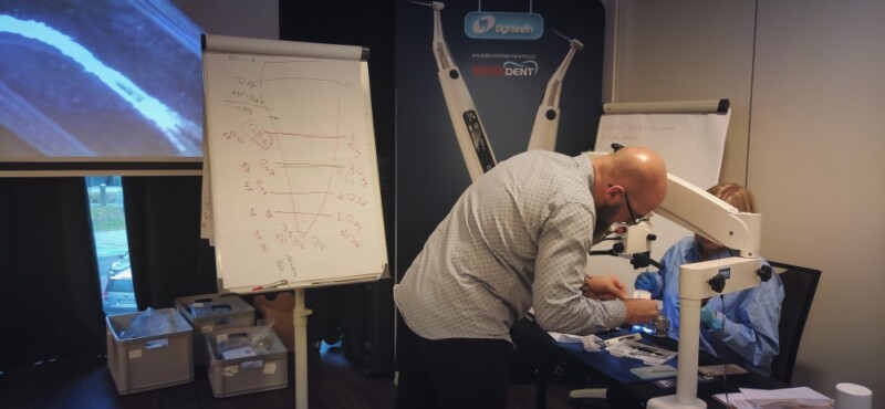 Obturacja systemu endodontycznego metodą termiczną