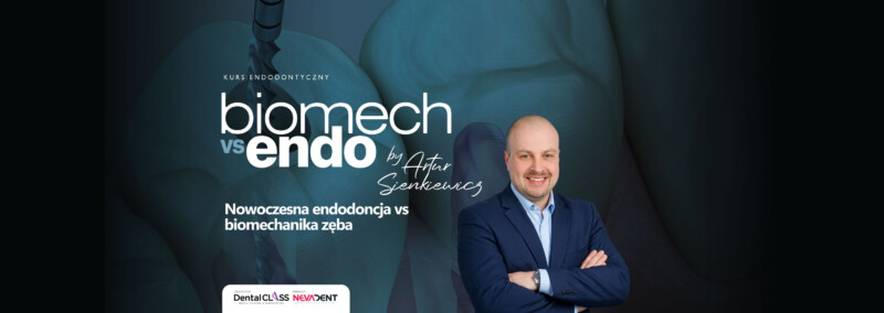 Nowoczesna endodoncja VS biomechanika zęba