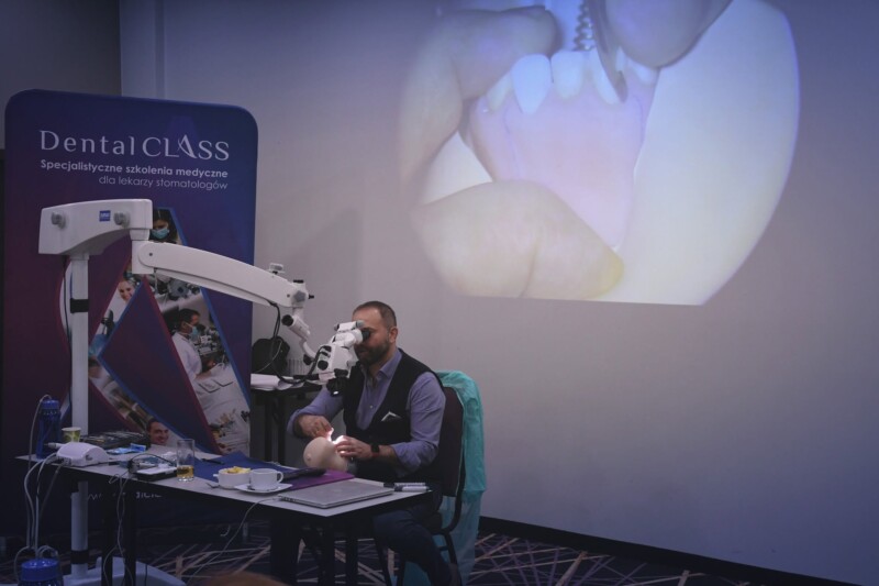 Mikrochirurgia Endodontyczna
