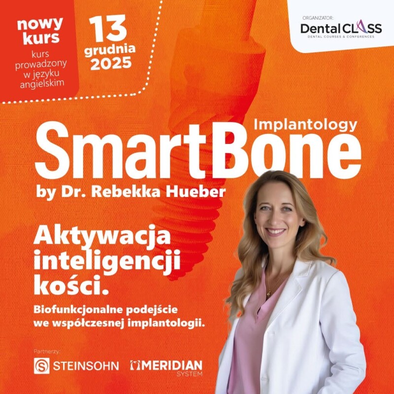 Smart Bone
