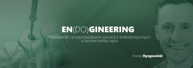 EN(DO)GINEERING Planowanie i przeprowadzanie procedur endodontycznych a biomechanika zęba