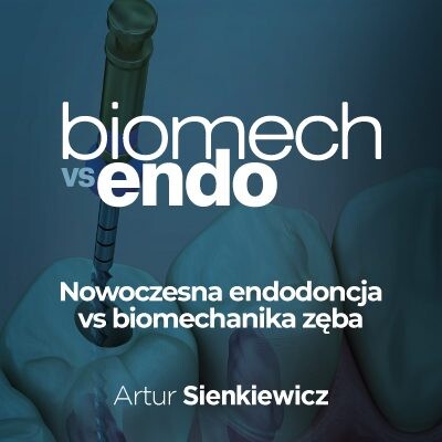Nowoczesna endodoncja VS biomechanika zęba