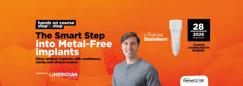 The Smart Step into Metal- free implants